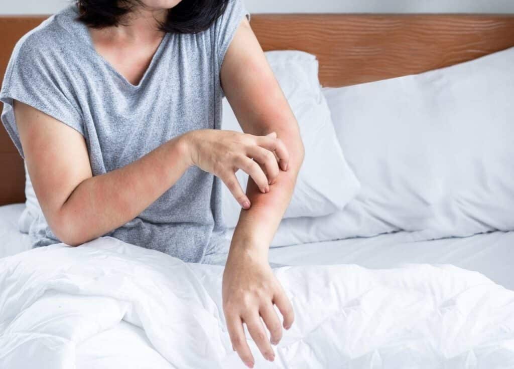 diy bed bug treatment