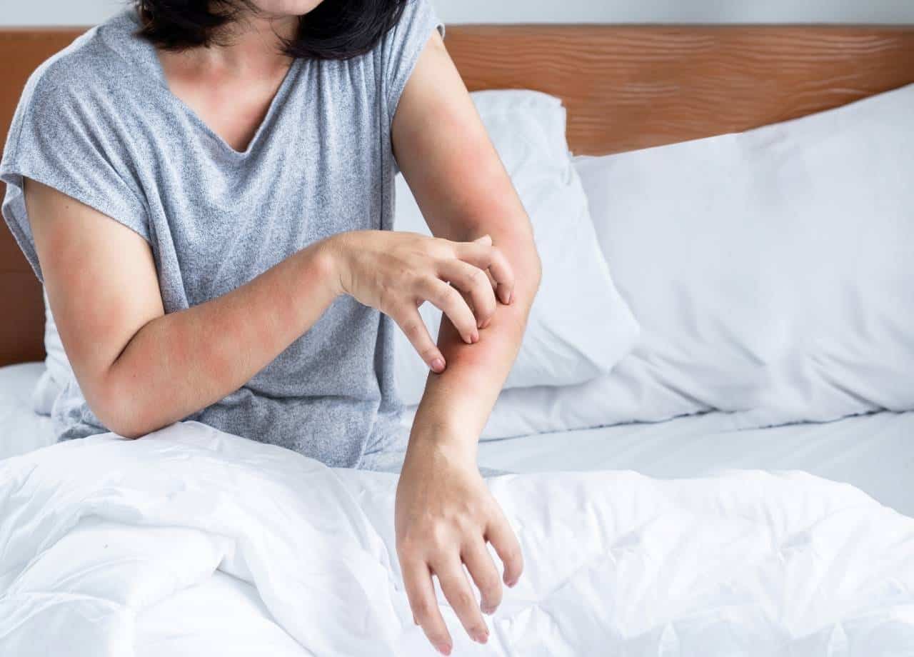 diy bed bug treatment